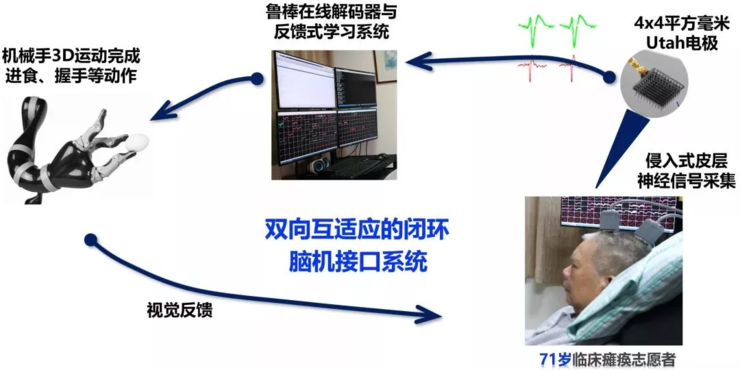 脑机接口技术，最新突破性进展与未来应用蓝图